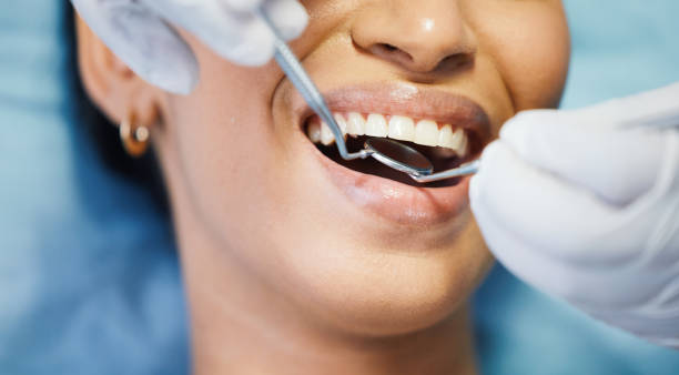 Best Emergency Tooth Extraction in Royalton, MN
